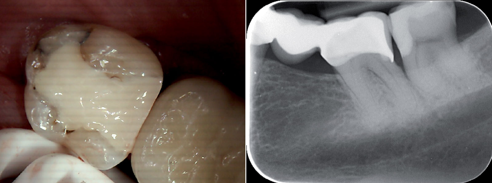 Fig-4-5-Equia Forte case