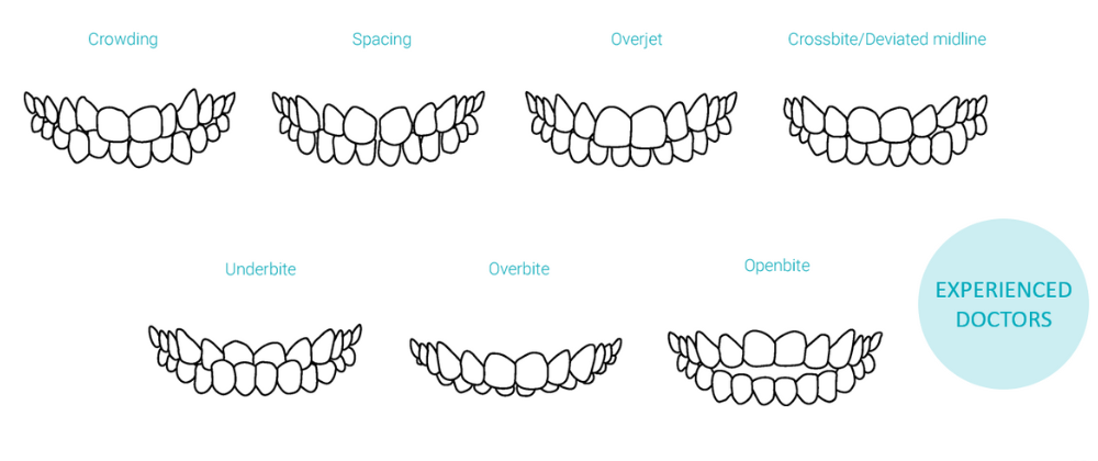 Treatment cases heysmile.png